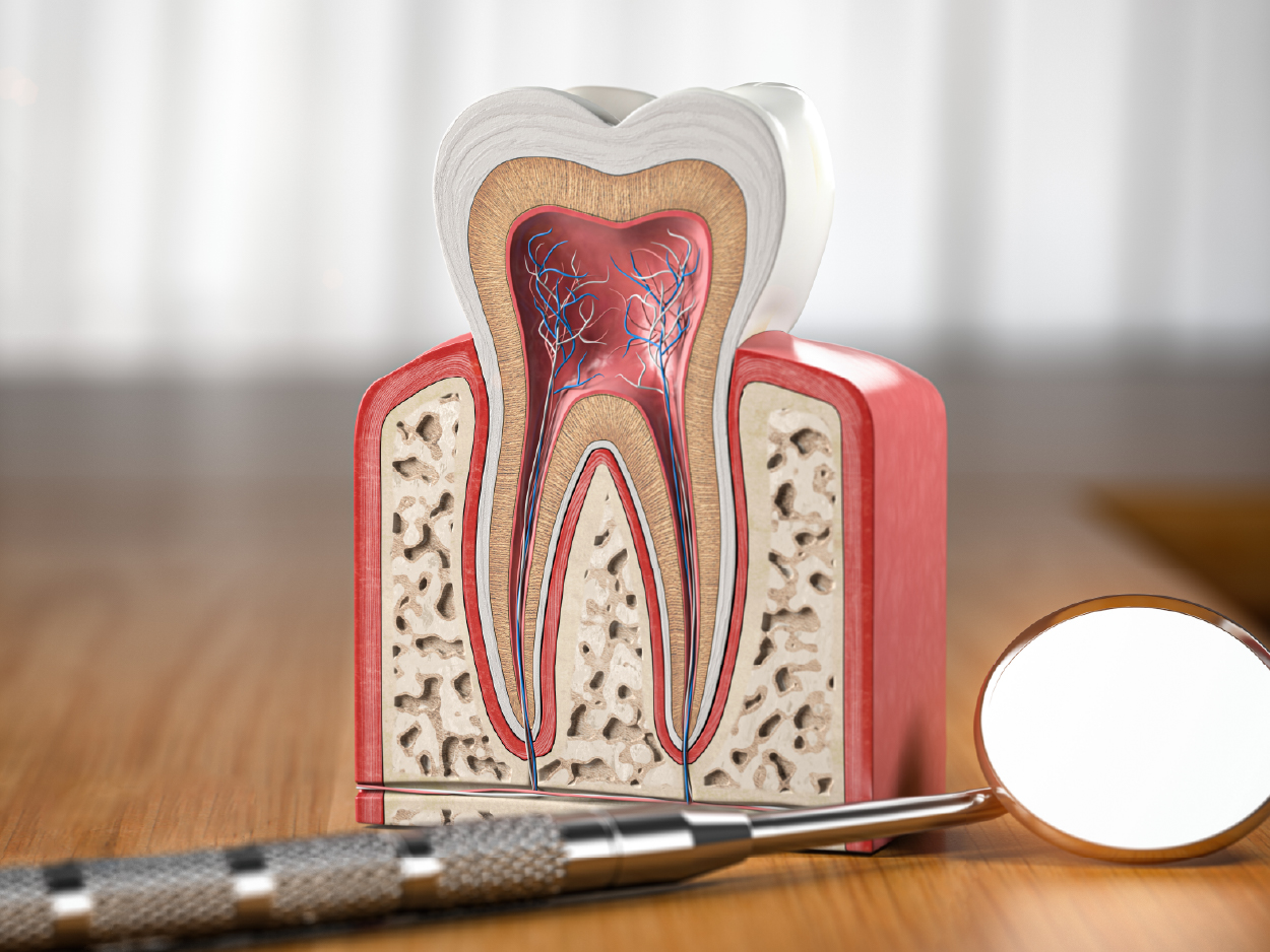 model showing a root canal 